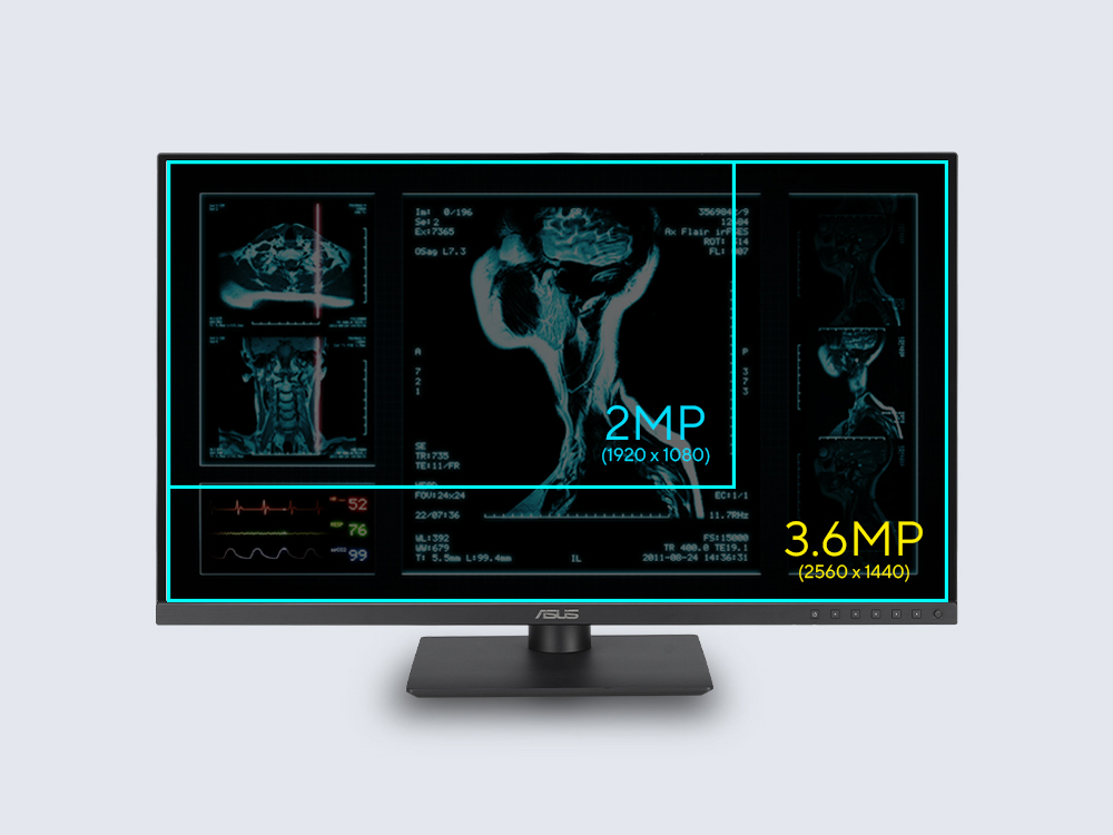 ASUS 27" IPS HA2741A 5MS 75HZ HDMI-DP TYPEC Medikal Pivot Monitör 2560x1440