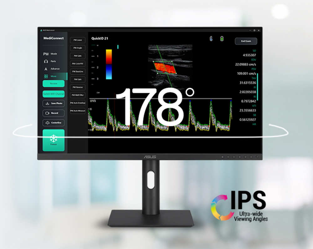 ASUS 23.8" IPS HA2441A 5MS HDMI-DP TYPEC Pivot Sağlık Monirtörü 2560x1440