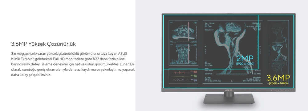ASUS 23.8" IPS MH2441A HDMI-DP TYPEC Pivot Klinik Monitör 2560x1440