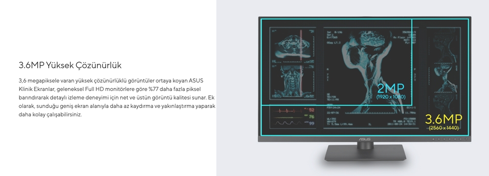 ASUS 27" IPS MH2741A 5MS 75HZ HDMI-DP TYPEC Pivot Klinik Monitör 2560x1440