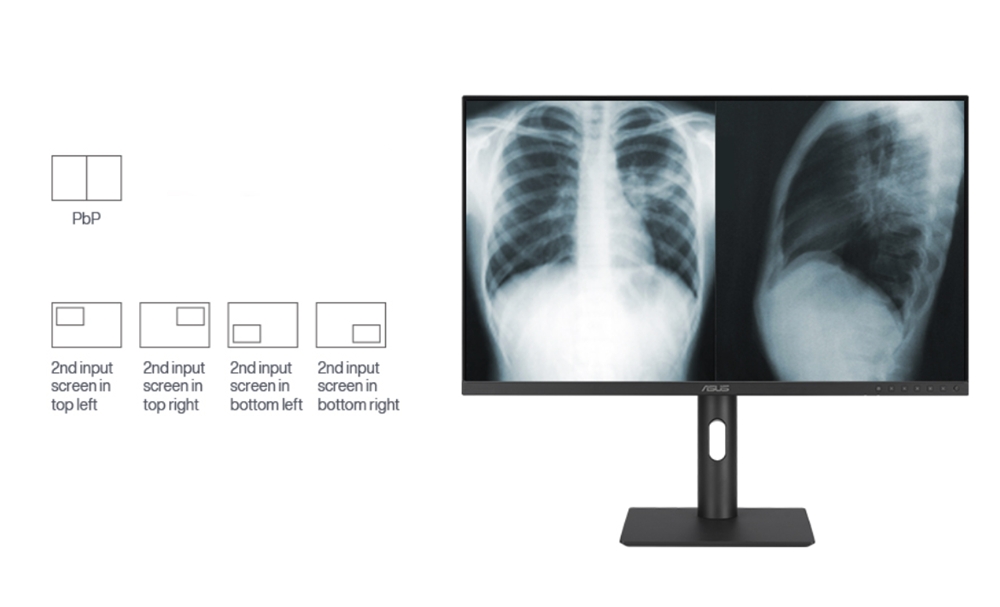 ASUS 27" IPS MH2741A 5MS 75HZ HDMI-DP TYPEC Pivot Klinik Monitör 2560x1440
