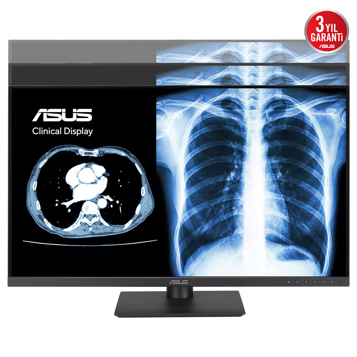 ASUS 27" IPS MH2741A 5MS 75HZ HDMI-DP TYPEC Pivot Klinik Monitör 2560x1440
